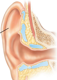 <p>What is the auricle pinna physically made of (tissue type + what it’s covered with)?</p>