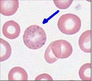 <p>Round or irregularly shaped granules of variable number and size, distributed throughout the RBC</p><ul><li><p>If you need to squint to see it than it not their </p></li></ul><p></p>