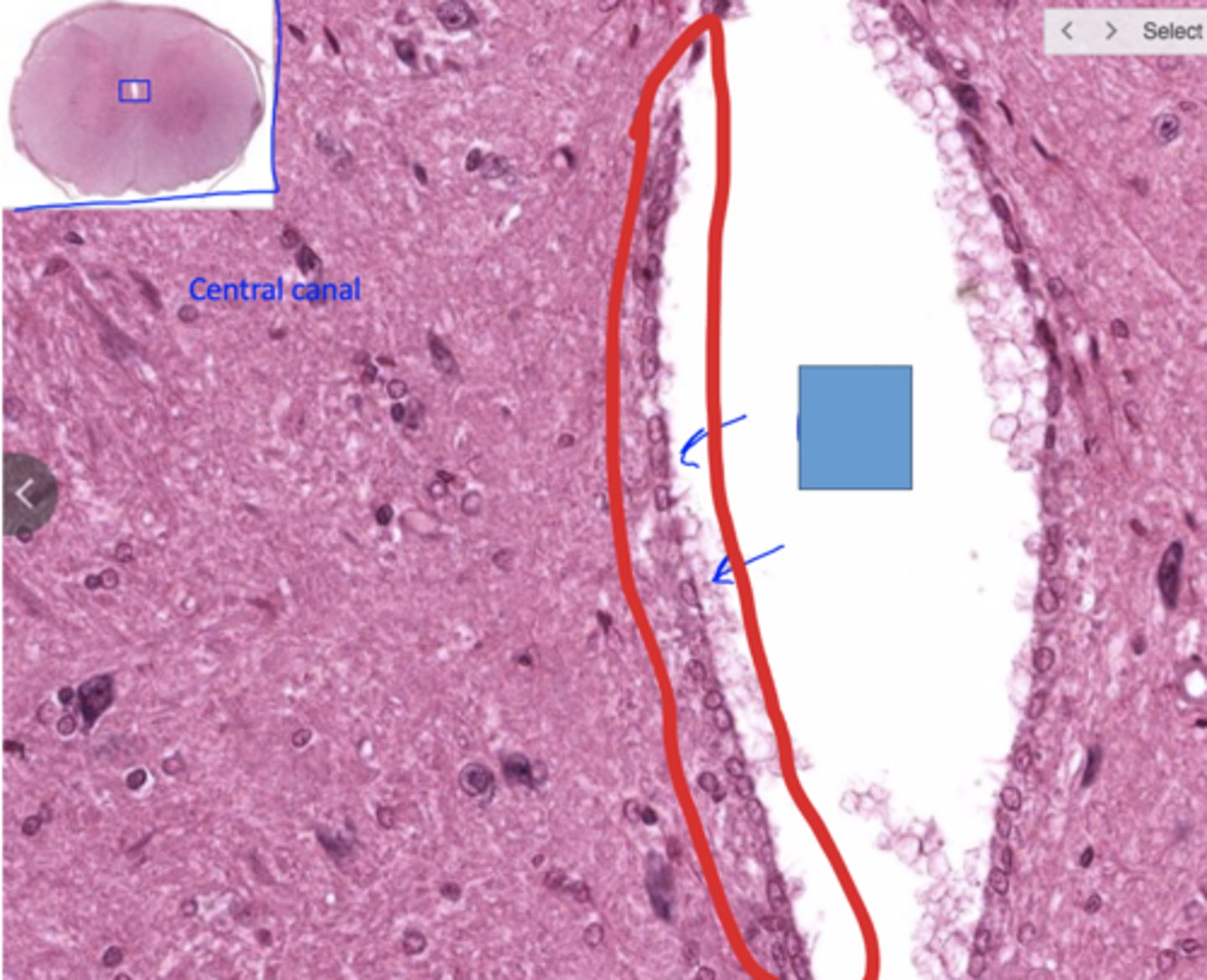 <p>Identify the following neuroglial cells</p>