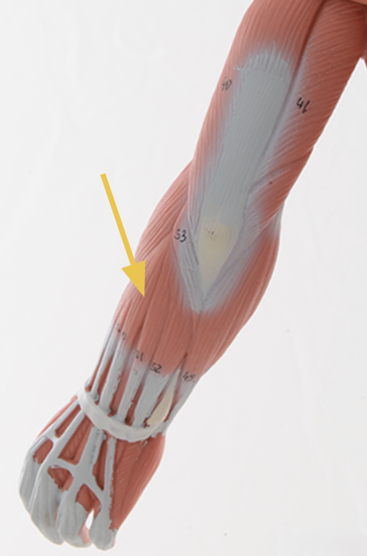 <p>extensor digitorum m.</p><p>O: lateral epicondyle (humerus)<br>I: dorsal surface of digits 2-5<br>A: <span>wrist, MCP, IP extension</span><br>Inn: radial n.</p>