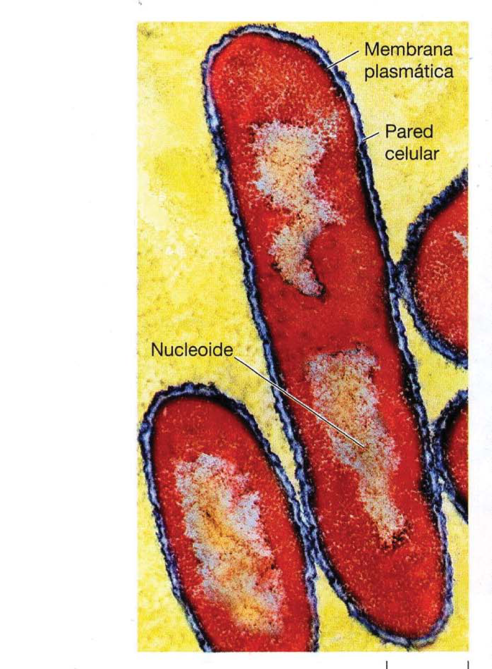 la estructura de la celula procariota tipica es la de Escherichia coli (E. coli) 