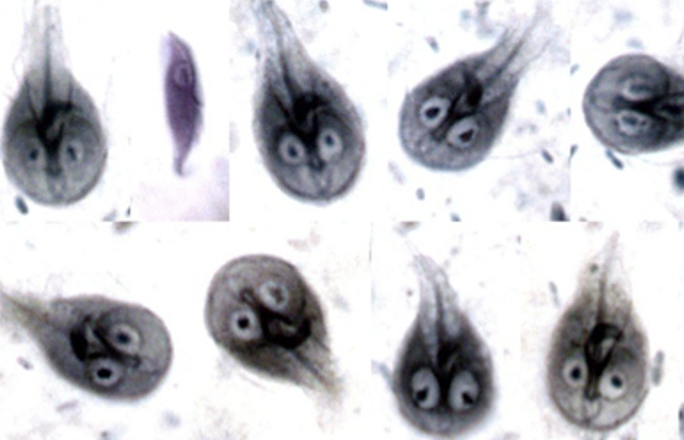 <p><span style="font-size: calc(var(--scale-factor)*12.00px);"><span>Name; Giardia duodenalis (lamblia, intestinalis)</span></span></p><p><span>Stage: trophozoite</span></p><ul><li><p><span>new cyst have 2 nuceli</span></p></li><li><p><span>older 4</span></p></li></ul><p></p>