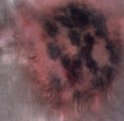 <ul><li><p><strong>Ventral-Type Alopecia (#1)</strong></p><ul><li><p><span style="color: rgb(136, 136, 136);"><strong>Sig: </strong></span>Dachshund, Chihuahua, MinPin, Whippet, Greyhound, Italian Greyhound, Terriers, Boxer, 6m</p></li><li><p><span style="color: rgb(136, 136, 136);"><strong>Cs:</strong></span><strong> </strong><u>Symmetrical, progressive, ventral neck, chest, abdomen, caudomedial thighs, perineum, postauricular regions</u></p><ul><li><p>Normal coat at birth</p></li></ul></li></ul></li><li><p><strong>Pinnal Alopecia</strong></p><ul><li><p><span style="color: rgb(136, 136, 136);"><strong>Sig: </strong></span>Dachshund, Chihuahua, Boston Terrier, Whippet, Italian Greyhound, &lt;1y</p></li><li><p><span style="color: rgb(136, 136, 136);"><strong>Dt:</strong></span><strong> </strong>biopsy (in anagen, reduced size/diameter of air folicle)</p></li><li><p><span style="color: rgb(136, 136, 136);"><strong>Tx:</strong></span><strong> </strong>none, melatonin trialed</p></li></ul></li></ul><ul><li><p><strong>Injection Reactions</strong></p><ul><li><p><span style="color: rgb(136, 136, 136);"><strong>Et:</strong> </span>2-4 months post-injection,<strong><u> rabies vax (inflam), steroid injection (non inflam)</u></strong></p></li><li><p><span style="color: rgb(136, 136, 136);"><strong>Cs:</strong> </span><u>erythematous firm plaque</u>, SQ swelling,&nbsp; alopecia, hyperpigmentation, shiny skin</p><ul><li><p>shoulders, back, posterolateral thighs</p></li></ul></li><li><p><span style="color: rgb(136, 136, 136);"><strong>Dt: </strong></span>biopsy (<strong>panniculitis</strong>, dermal/pilosebaceous atrophy)</p></li><li><p><span style="color: rgb(136, 136, 136);"><strong>Tx:</strong></span><strong> </strong>none, excision, Intralesional/systemic GC, pentoxifylline, dapsone</p></li></ul></li><li><p><strong>Post-Clipping Alopecia</strong></p><ul><li><p><span style="color: rgb(136, 136, 136);"><strong>Et:<u> </u></strong></span><u>failure of hair regrowth post-clippin</u>g (follicular arrest)</p></li><li><p><span style="color: rgb(136, 136, 136);"><strong>Sig:</strong></span><strong> </strong><u>long/thick coats</u>; Siberian Husky, Chow</p></li><li><p><span style="color: rgb(136, 136, 136);"><strong>Tx:</strong></span><strong> </strong>regrows after heavy shedding</p></li></ul></li><li><p><strong>Recurrent Flank Alopecia</strong></p><ul><li><p><span style="color: rgb(136, 136, 136);"><strong>Et:</strong> </span><strong><u>seasonal follicular dysplasia; fall/winter, photoperiod, genetics</u></strong></p></li><li><p><span style="color: rgb(136, 136, 136);"><strong>Sig:</strong></span><span style="color: red;"> <strong><u>Boxers, Bulldogs</u></strong></span><strong><u>, Airedales, Schnauzers, Poodles, Frenchies</u></strong></p></li><li><p><span style="color: rgb(136, 136, 136);"><strong>Cs: </strong></span><strong><u>well-demarcated alopecia, hyperpigmentation, scaling, folliculitis</u></strong></p><ul><li><p><strong><u>Symmetric, Sporadic, bon-pruritic, non-inflamed,</u></strong></p></li></ul></li><li><p><span style="color: rgb(136, 136, 136);"><strong>Dt:<u> </u></strong></span><strong><u>biopsy (dysplastic/atrophic, keratin-filled follicles w/ finger-like projections)</u></strong></p></li><li><p><span style="color: rgb(136, 136, 136);"><strong>Tx: </strong></span><strong><u>regrowth in 3-8m, melatonin</u></strong></p></li></ul></li></ul><p></p>