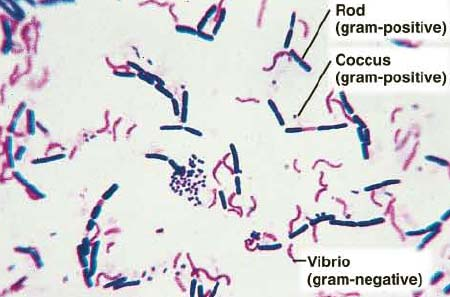 <p><strong>Gram stain process</strong> - Step 1 </p>