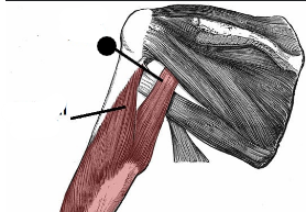term image