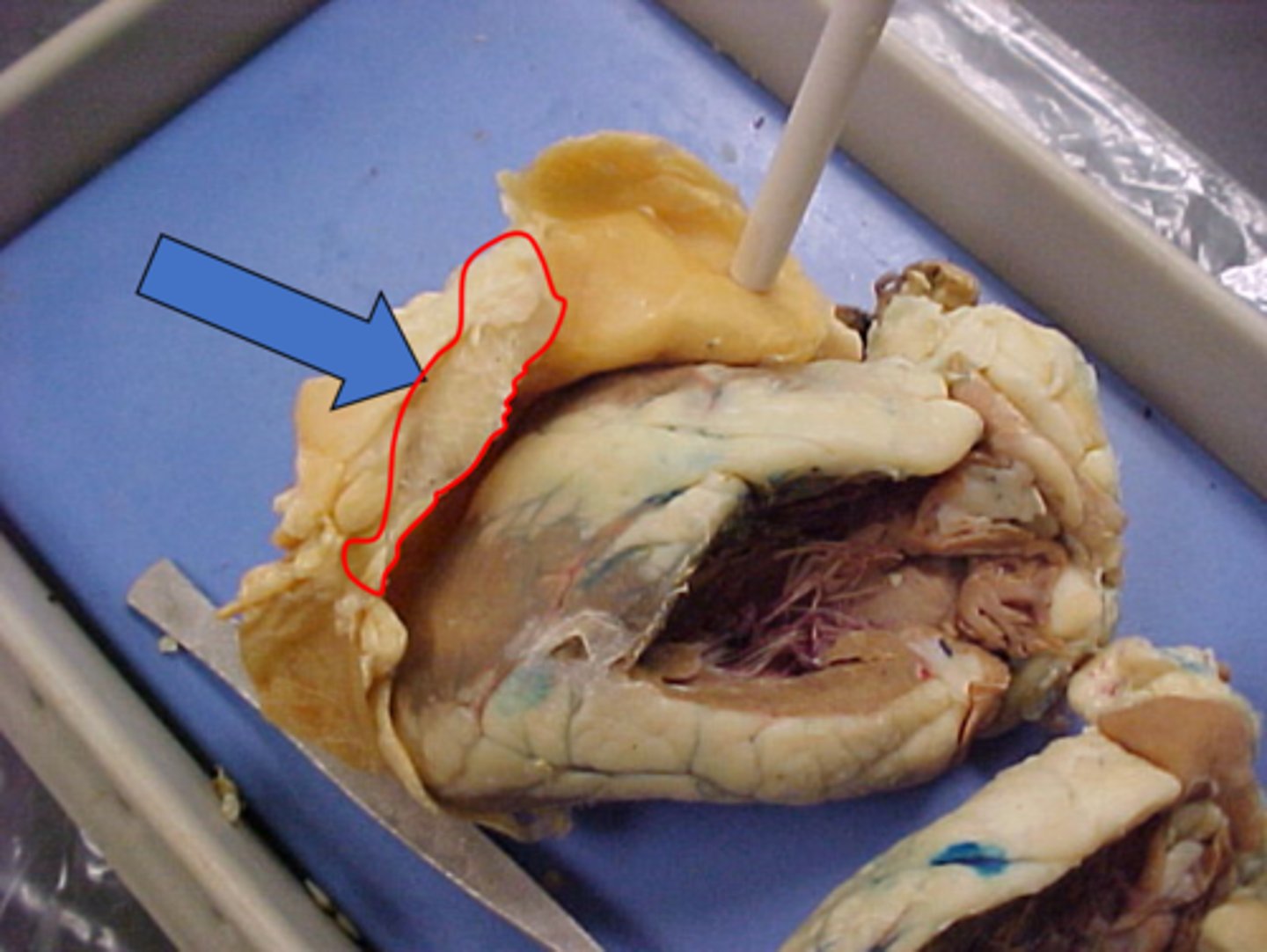 <p>Name this outermost layer</p>