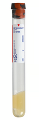 <p>Which anticoagulant does this tube contain?</p>
