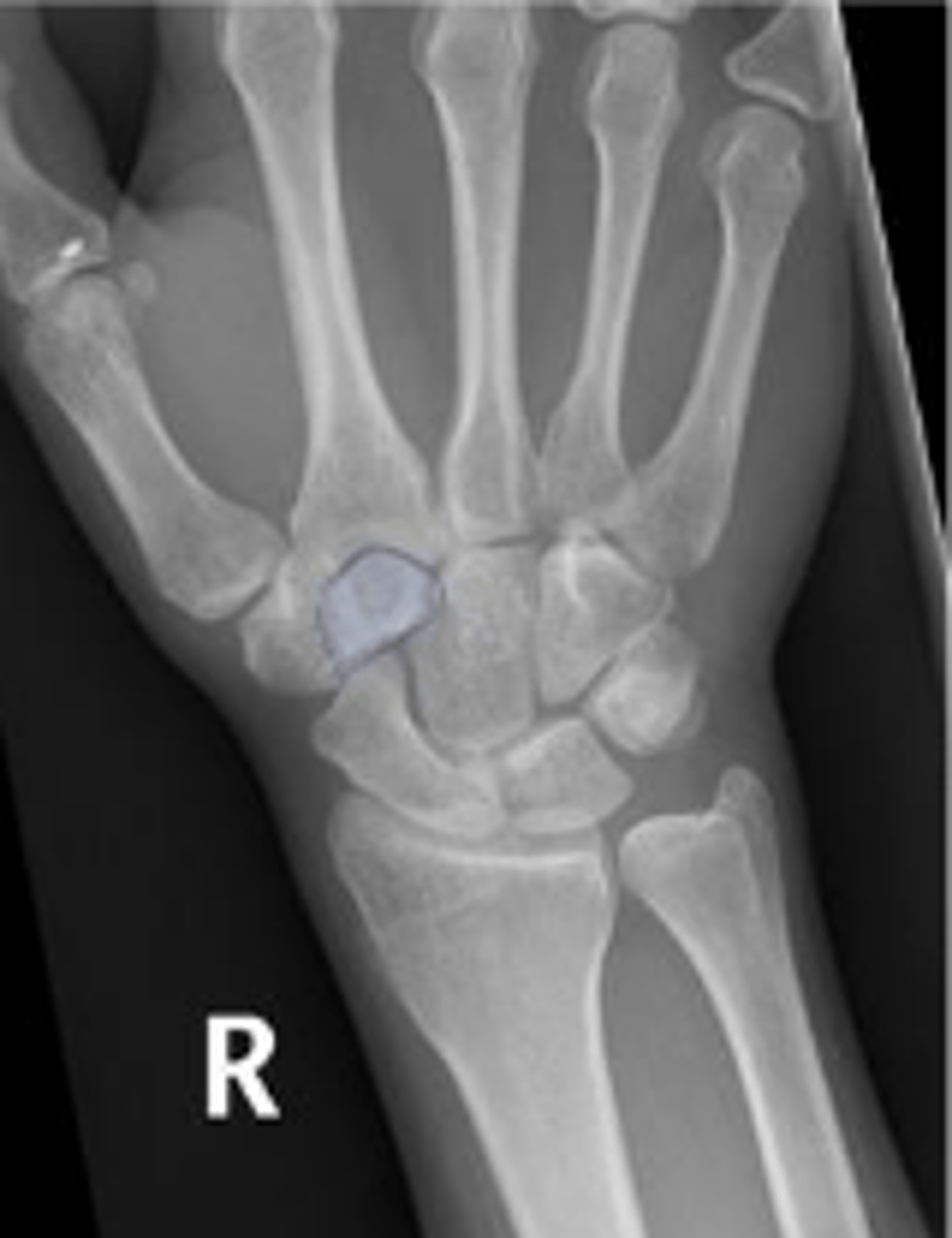 <p>What is outlined?</p>