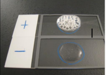 <p>Catalase Test</p>