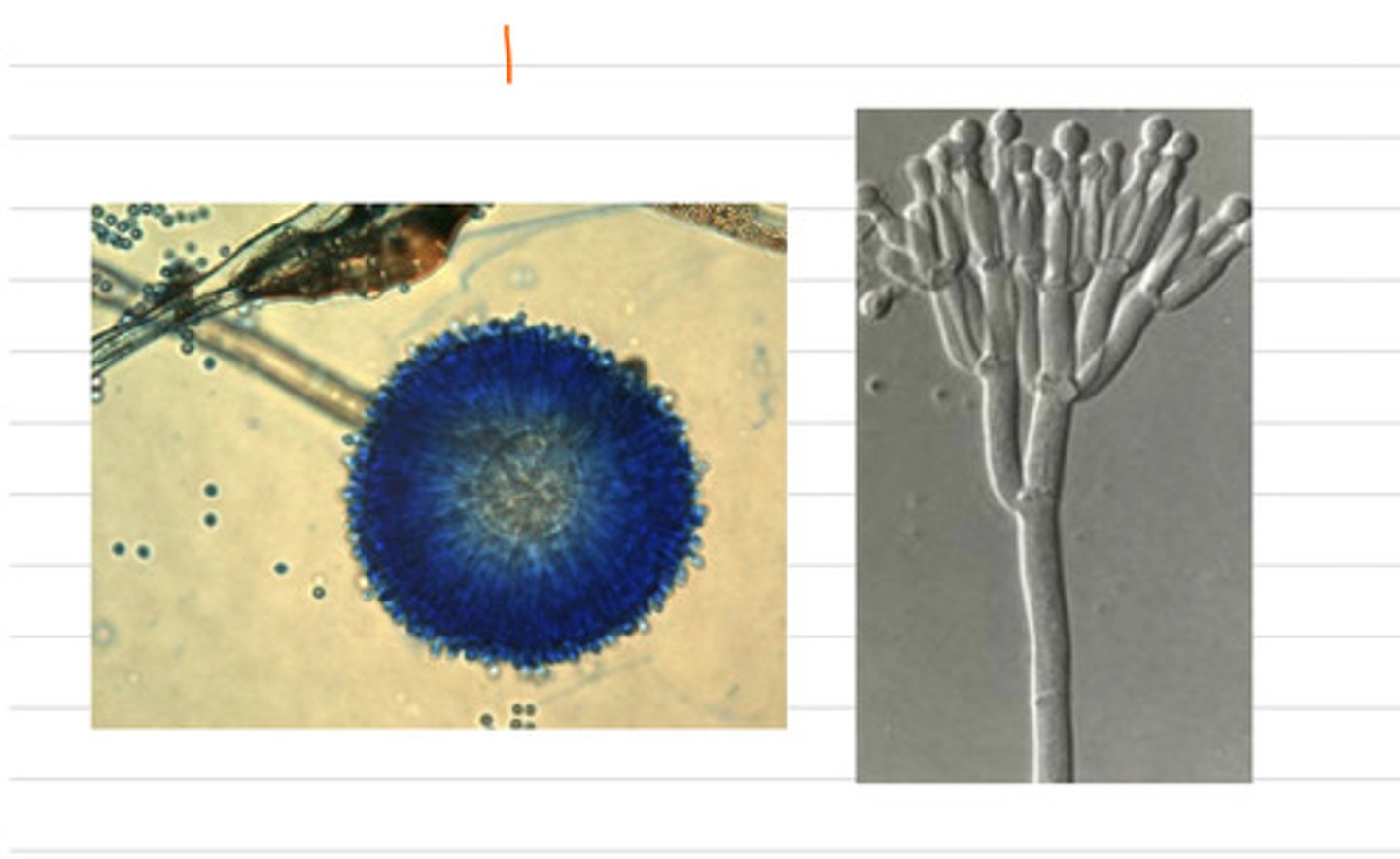 <p>a farmer notices his pig has lost his appetite, so he has lost lots of weight, and is also drinking and peeing a lot more than normal.</p><p>what could be the diagnosis?</p>
