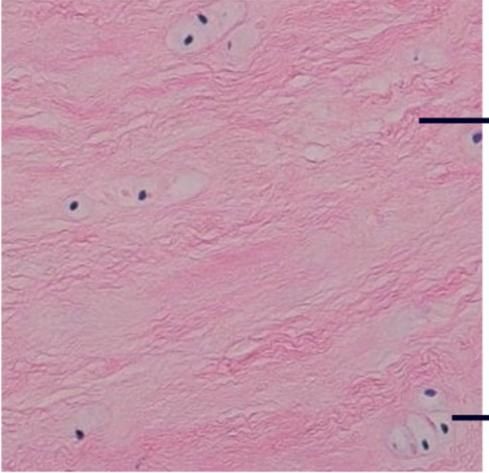 1. Contains little ground substance 
2. Matrix has thick, dense collagen fibers
3. Resists strong compression
4. Found in
- Intervertebral disks
- Knee joint
- Pubic symphysis
- Meniscus