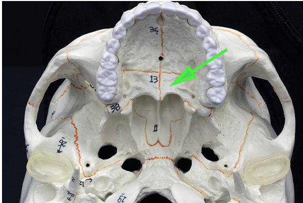 <p>What bone is indicated by the green arrow?</p>