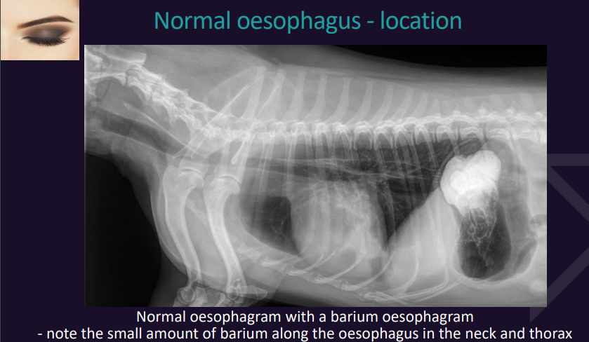 <p>Oesophagus</p><p>Normal oesophagus - location</p><p>VD view?</p><p>Lateral view?</p>