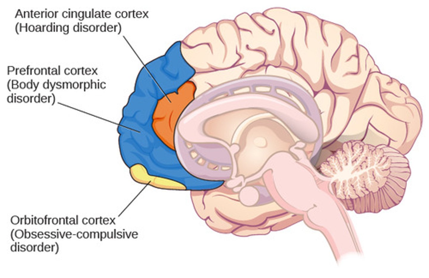 <p>A: Controls emotion regulation, impulse control, and social behavior. Damage leads to impulsivity, disinhibition, lack of empathy. Involved in depression, bipolar, OCD, PTSD, addiction.</p>