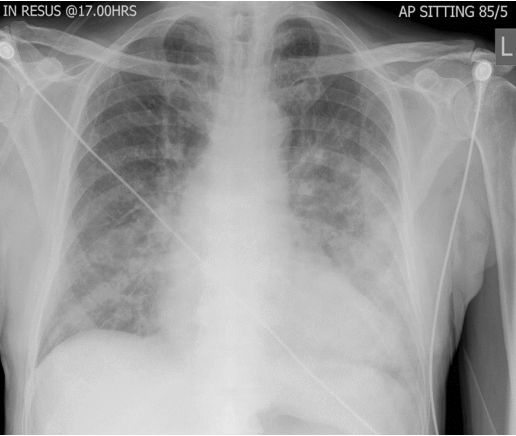 <p>What is this pathology?</p>