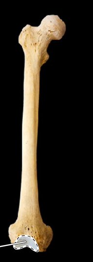 <p>Femur, anterior view, right side</p>
