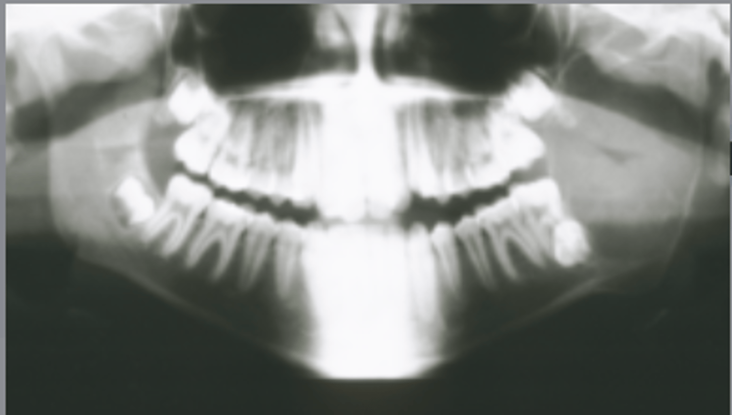 <p>What would be included in your D/D?</p>