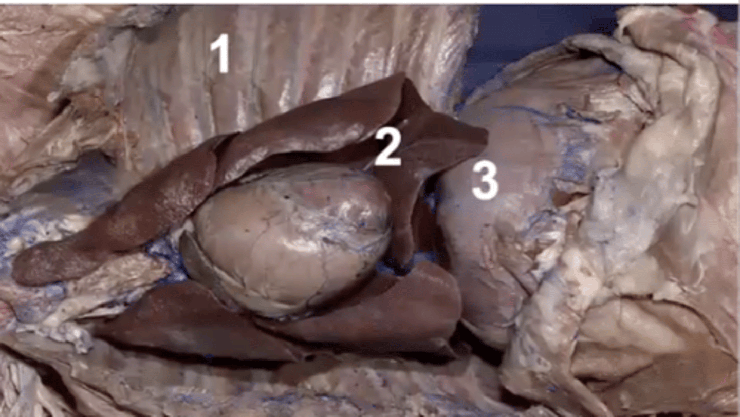 <p>What type of pleura is 2?</p>