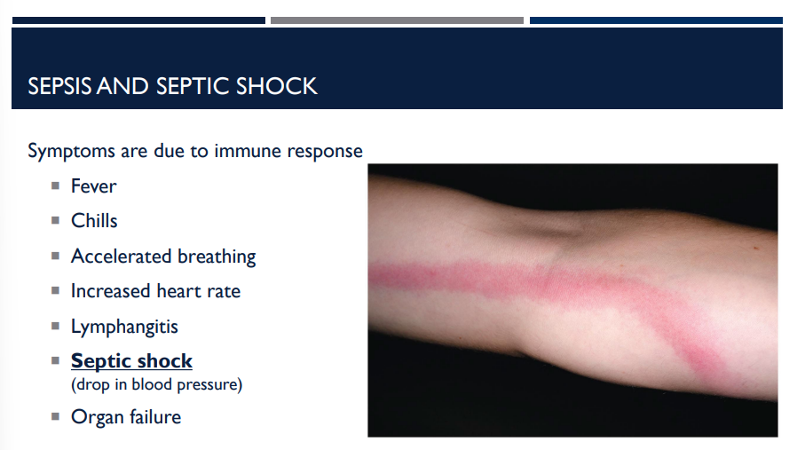 <p>The following symptoms are present in a patient:</p><ul><li><p>Fever</p></li><li><p>Chills</p></li><li><p>Accelerated breathing</p></li><li><p>Increased heart rate</p></li><li><p>Lymphangitis</p></li><li><p>Septic shock (drop in blood pressure)</p></li><li><p>Organ failure</p></li></ul><p></p><p>What are they likely going through?</p>