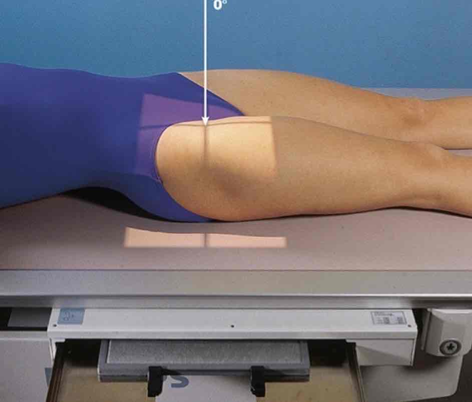 <p>What Projection is this?</p>