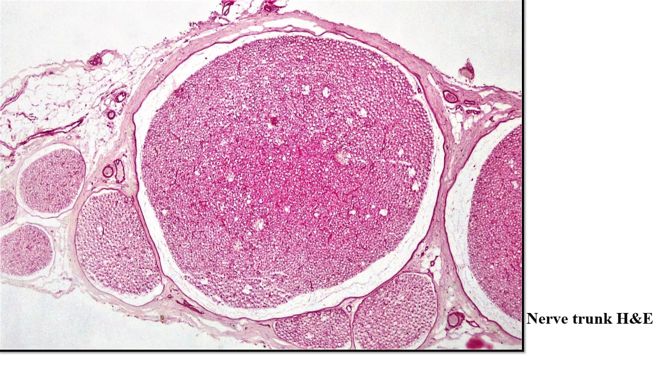 <p>Nerve trunk – LM – H&E</p>