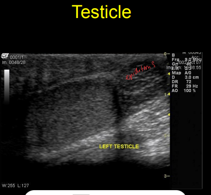 <ul><li><p><strong>Testies</strong></p><ul><li><p>homogeneous, smooth</p></li><li><p>Mid linear, hyperechoic “<strong>rete testis</strong>”</p></li></ul></li><li><p><strong>Prostate gland</strong></p><ul><li><p>Can hide behind pubis</p></li><li><p>moderately hyperechoic and uniform</p></li></ul></li></ul><p></p>