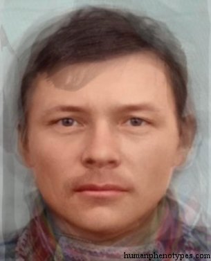 <p>Identify this Phenotype </p>