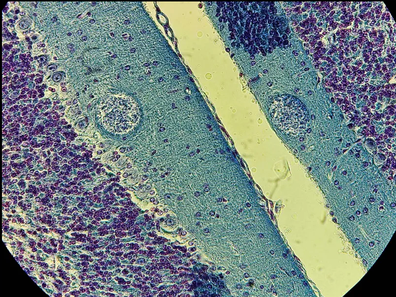<p><span data-name="microscope" data-type="emoji">🔬</span><span data-name="petri_dish" data-type="emoji">🧫</span><strong><span> </span>Na podstawie zdjęcia preparatu:</strong></p><p></p><ul><li><p><span>📖 </span>rozpoznaj gatunek pasożyta;</p></li></ul><p></p><ul><li><p><span>♻ </span>rozpoznaj wszystkie formy rozwojowe;</p></li></ul><p></p><ul><li><p><span>🦠 </span>wskaż organelle i cechy charakterystyczne dla danego gatunku;</p></li></ul><p></p><ul><li><p><span>😷 </span>nazwij chorobę, którą pasożyt wywołuje.</p></li></ul><p></p>