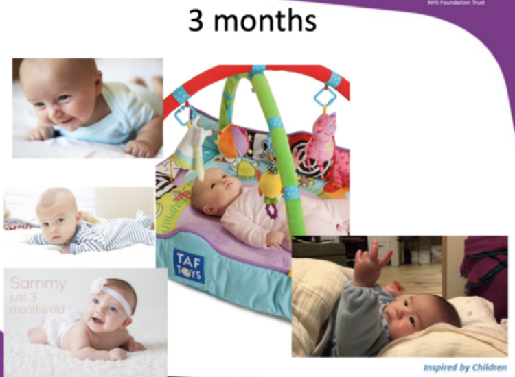 <ul><li><p><strong>symmetrical</strong> UE and LE movements</p></li><li><p style="text-align: left"><strong><mark data-color="purple" style="background-color: purple; color: inherit">sitting:</mark></strong> head control in <strong>supported sitting</strong></p></li><li><p style="text-align: left"><strong><mark data-color="purple" style="background-color: purple; color: inherit">prone:</mark></strong></p><ul><li><p style="text-align: left">props on <strong>forearms</strong></p></li><li><p style="text-align: left">holds head at 45-90 degrees</p></li></ul></li><li><p style="text-align: left"><strong><mark data-color="purple" style="background-color: purple; color: inherit">supine:</mark></strong></p><ul><li><p style="text-align: left">bring legs together in midline</p></li><li><p style="text-align: left">tuck chin and extend neck</p></li></ul></li><li><p style="text-align: left"><strong><mark data-color="purple" style="background-color: purple; color: inherit">standing:</mark></strong></p><ul><li><p style="text-align: left">bears some weight, head control while supported</p></li></ul></li><li><p style="text-align: left"><strong>roll</strong> <em>tummy to back</em></p><ul><li><p style="text-align: left"><em><mark data-color="yellow" style="background-color: yellow; color: inherit">supine to sidelying > prone to supine</mark></em></p></li></ul></li></ul><p></p>