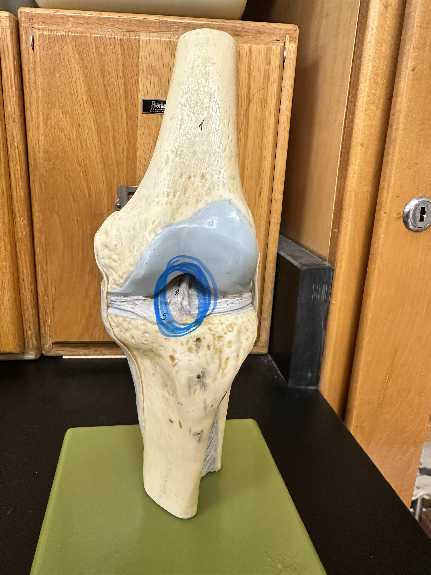 <p>Anterior cruciate ligament </p>
