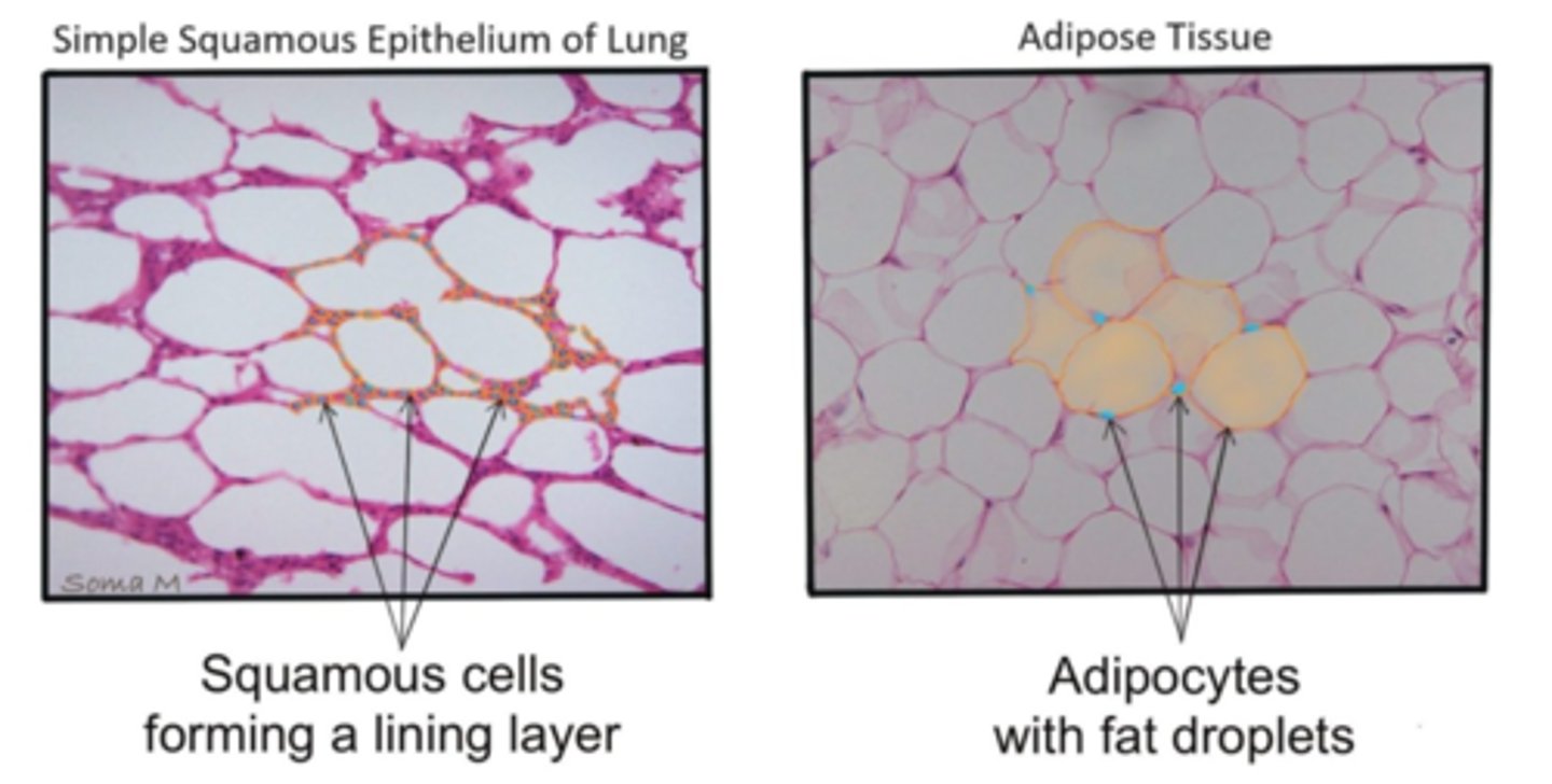 <p>Lung epithelium form a squamous lining layer, with nuclei pushed to the side. Adipocytes have one nucleus that is pushed off to the sides.</p>