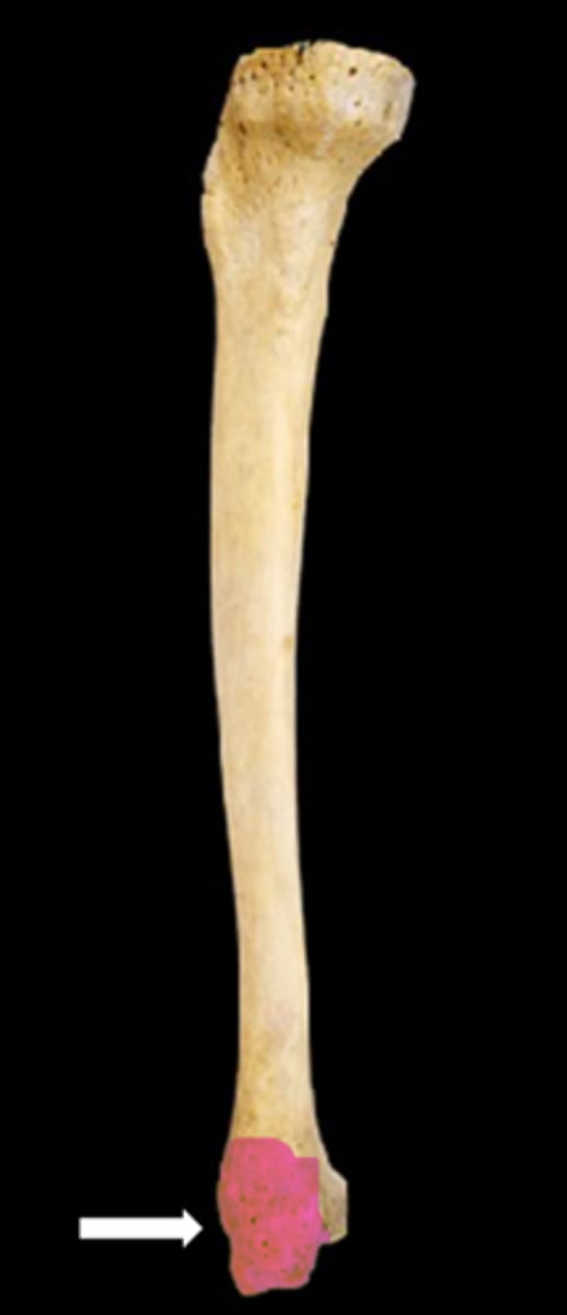 <p>name the part</p>