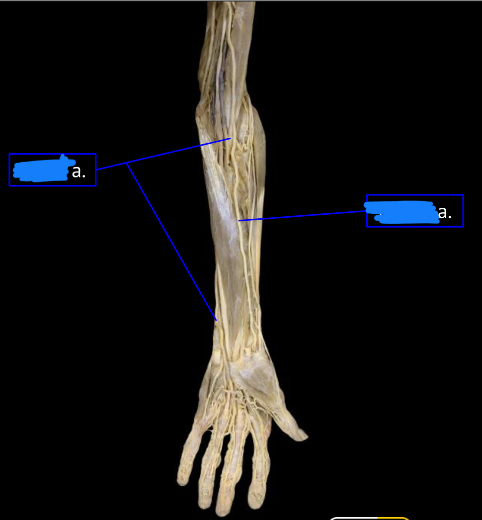 <p>left artery</p>