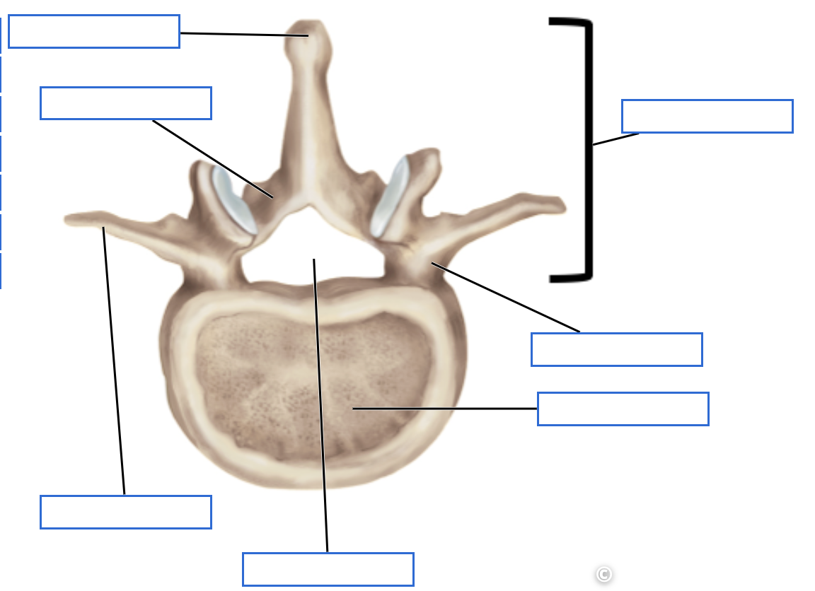<p>Identify the bone features of the typical vertebrae</p>