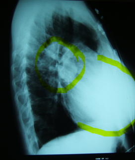 term image