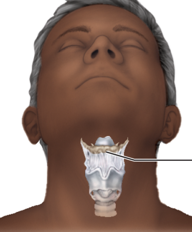 <p>What bone is this?</p>