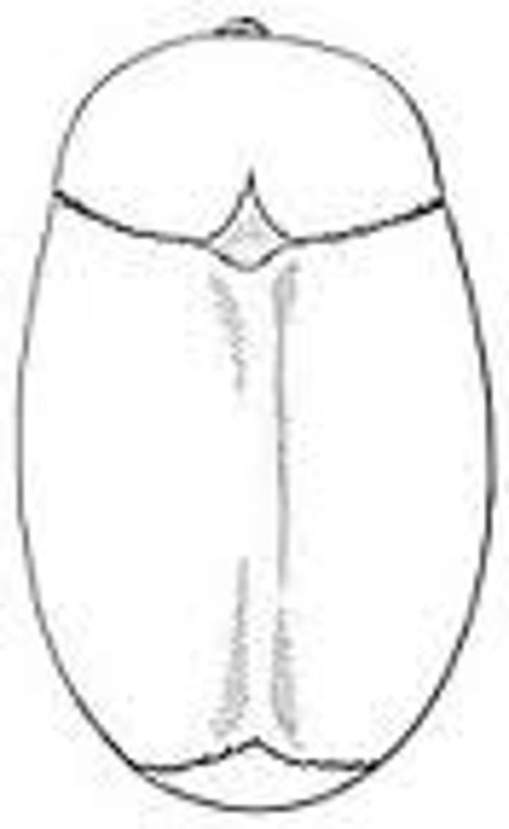 <p>premature closure of sagittal suture resulting in posterior elongation</p>