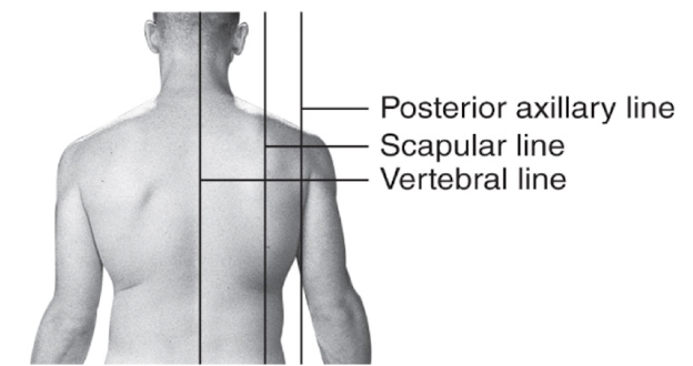 <p>Vertical line running along the <strong>spinous processes of the vertebral column</strong>.</p>