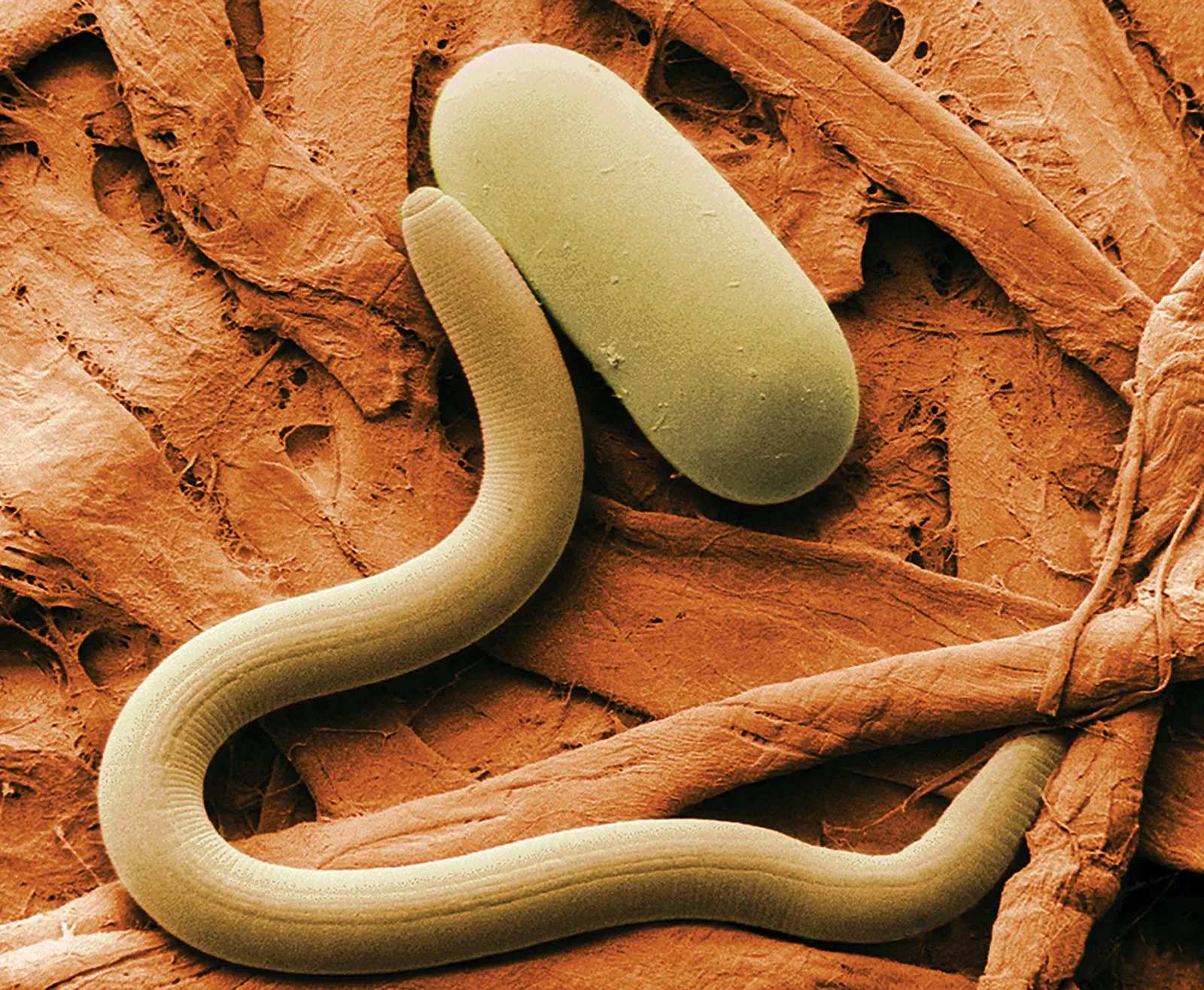 <p>Roundworms</p>