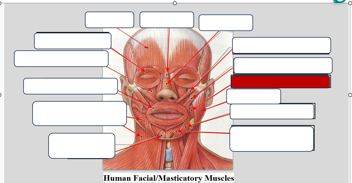 <p>Label the muscle </p>