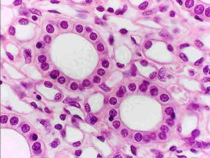 <p><strong>Picture example of a simple cuboidal epithelium tissue:</strong></p>