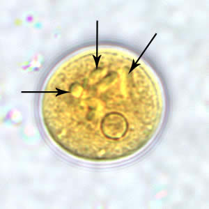 <p>large nucleus with numerous chromatoid</p>