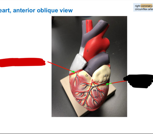 <p>Name this heart vessel</p>