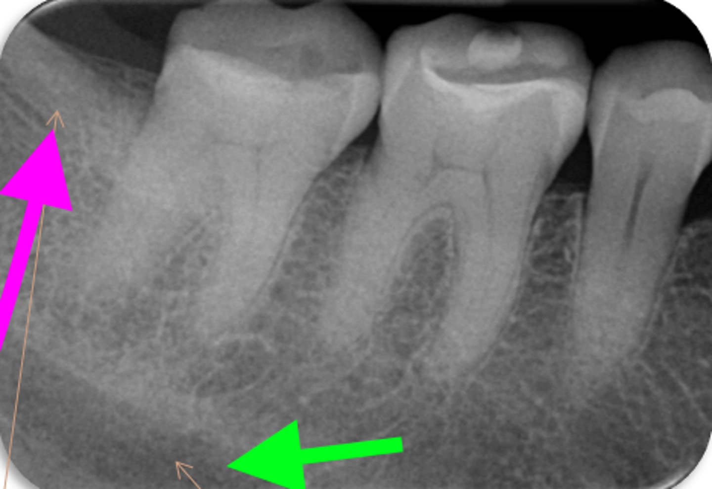<p>ID the structure with the green arrow:</p>