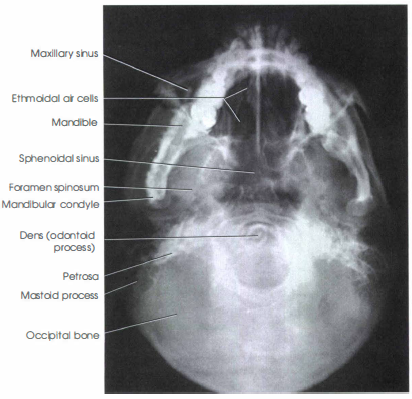 <p>MSP, IOML parallel to bucky, pt is looking straight up</p>