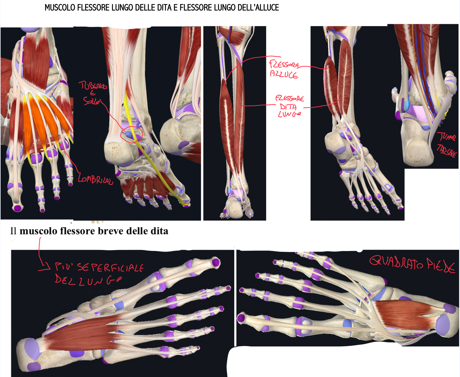 <p>MUSCOLO FLESSORE LUNGO DELLE DITA E DELL’ALLUCE:</p><ul><li><p>Il flessore lungo delle dita origina dalla superficie posteriore tibia e raggiunge le quattro falangi distali delle dita laterali</p><ul><li><p>Funzione → flessione articolazioni interfalangee e mantenimento arco longitudinale laterale</p></li><li><p>Inoltre origina i muscoli lombricali del piede</p></li></ul></li><li><p>Il flessore lungo dell’alluce origina dalla superficie posteriore fibula e raggiunge la falange distale del primo dito</p><ul><li><p>Funzione → flessione alluce e mantenimento arco longitudinale mediale</p></li></ul></li></ul><ul><li><p>Decorso → decorrono posteriormente il malleolo mediale e articolazione della caviglia, attraversano il tunnel tarsale e a livello della pianta del piede si incrociano (chiasma plantare)</p><ul><li><p>Il Flessore Lungo delle dita passa per il Solco Malleolare della tibia (insieme al tibiale posteriore)</p></li><li><p>Mentre il Flessore Lungo dell’Alluce passa per il Solco Malleolare di Talo e Calcagno</p></li></ul></li></ul><p>TUNNEL TARSALE:</p><ul><li><p>Limiti → malleolo mediale, talo e calcagno, chiuso dal retinacolo dei flessori</p></li><li><p>Contenuto:</p><ul><li><p>Tendine del muscolo tibiale posteriore, flessore lungo delle dita e dell’alluce</p></li><li><p>Arteria e vena tibiale posteriore (da arteria poplitea e vene plantari)</p></li><li><p>Nervo tibiale (dal nervo sciatico)</p></li></ul></li></ul><p>MUSCOLI INTRINSECI DEL PIEDE:</p><ul><li><p>Muscolo Flessore breve delle dita → teso tra tuberosità calcaneare e falangi medie 2-5 dito</p></li><li><p>Muscolo Quadrato del piede → dalla faccia plantare del calcagno al tendine comune del flessore lungo delle dita (contraendosi, modifica la direzione del tendine comune, favorendo la flessione delle dita)</p></li><li><p>Altri sono i lombricali, gli interossei palmari e dorsali, estensore breve dell’alluce, abduttore dell’alluce e mignolo, adduttore dell’alluce, flessore del mignolo</p></li></ul><p></p>