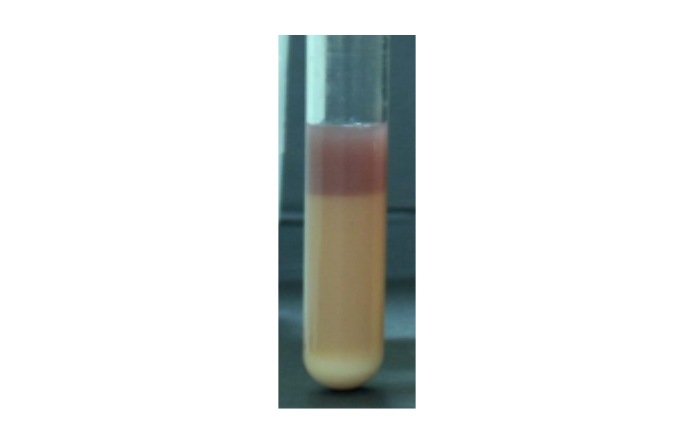 <p>Indicating elevated pH due to deamination </p>