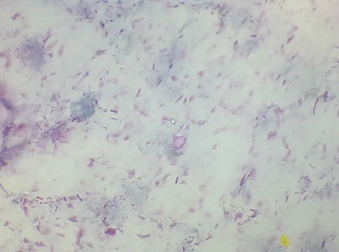 <p>in human or young calf</p><p>calf with diarrhea or human with GI signs</p><p>from an acid fast test</p>