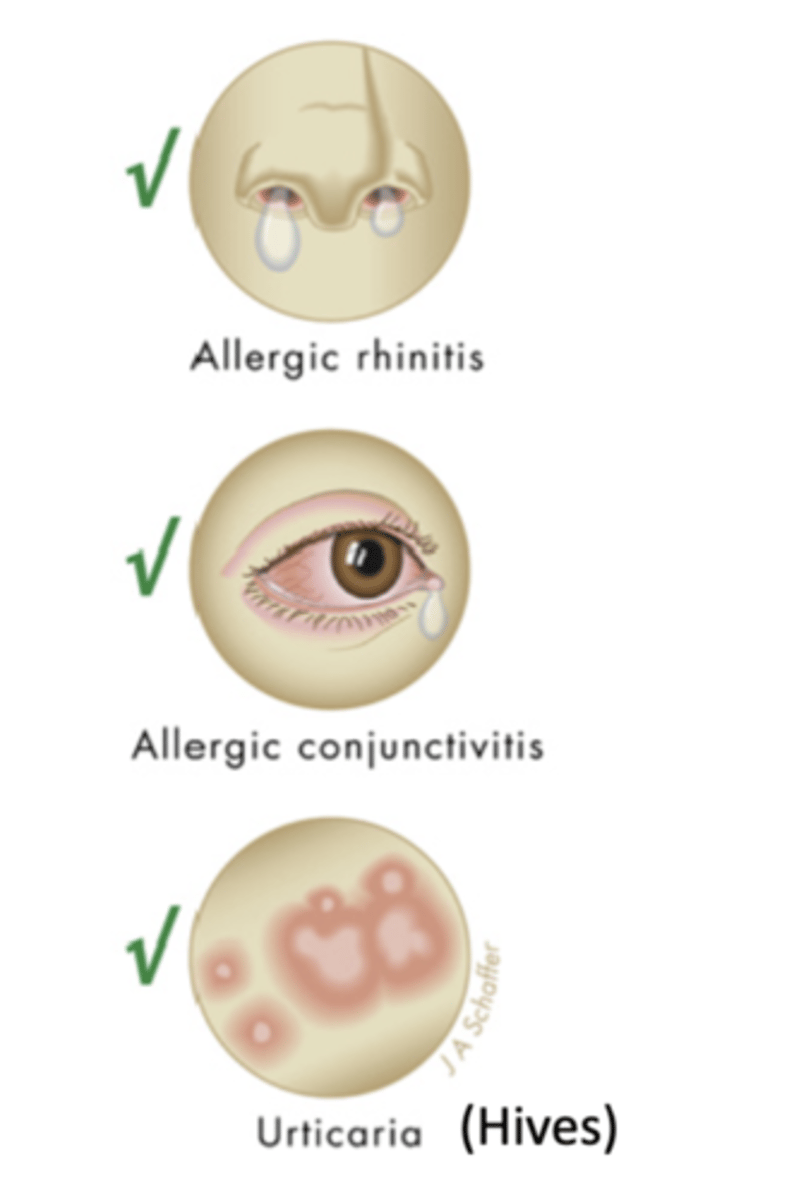 <p>pharmacological</p><p>- allergic rhinitis</p><p>- allergic conjunctivitis</p><p>- hives (urticaria)</p><p>other uses</p><p>- manage cold symptoms</p><p>- eczema</p><p>-itching from atopic dermatitis</p>