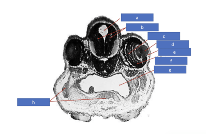 <p>identify E</p>